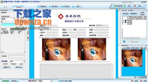 腹腔镜工作站 腹腔镜工作站