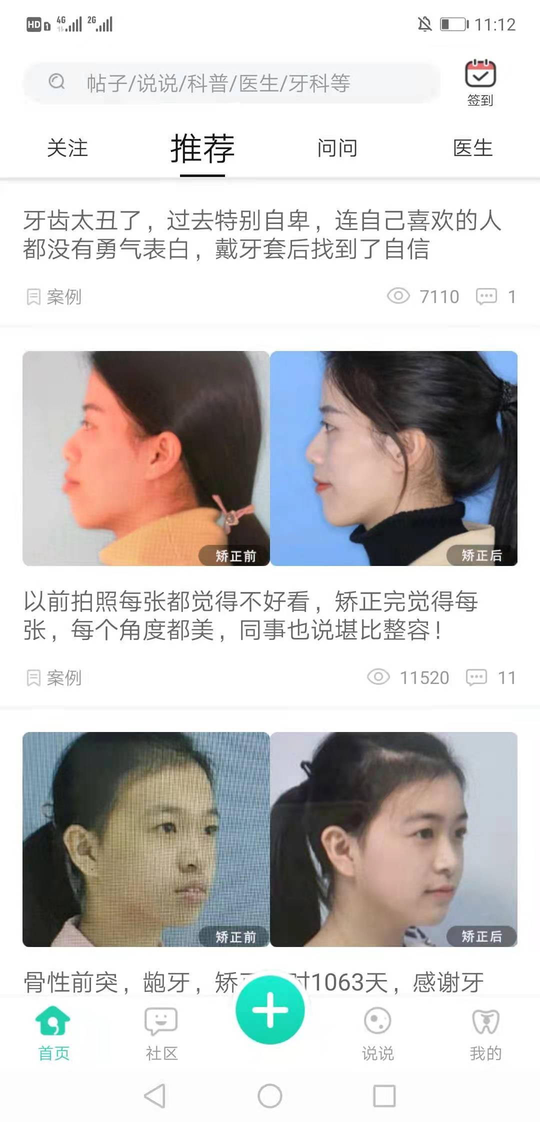 牙套之家截图